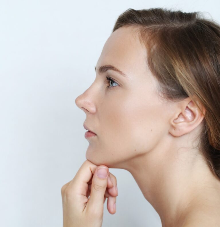 chin liposuction