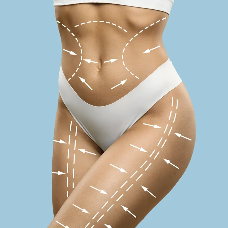 liposuction in turkey 6